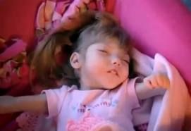 Τα παιδιά που στην πραγματικότητα πάσχουν από το σύνδρομο Μπέντζαμιν Μπάτον (εικόνες)