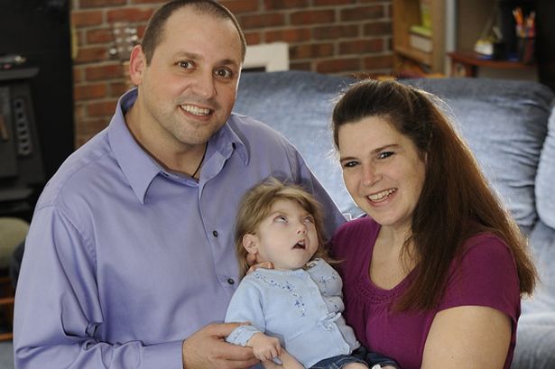 Τα παιδιά που στην πραγματικότητα πάσχουν από το σύνδρομο Μπέντζαμιν Μπάτον (εικόνες)