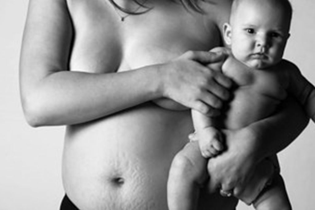 Το μεγαλείο της μητρότητας μέσα από φωτογραφίες που δείχνουν γυναικείο σώμα μετά τον τοκετό (pics)