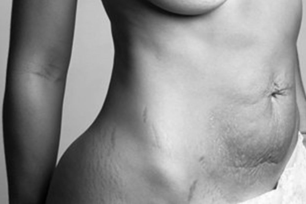 Το μεγαλείο της μητρότητας μέσα από φωτογραφίες που δείχνουν γυναικείο σώμα μετά τον τοκετό (pics)