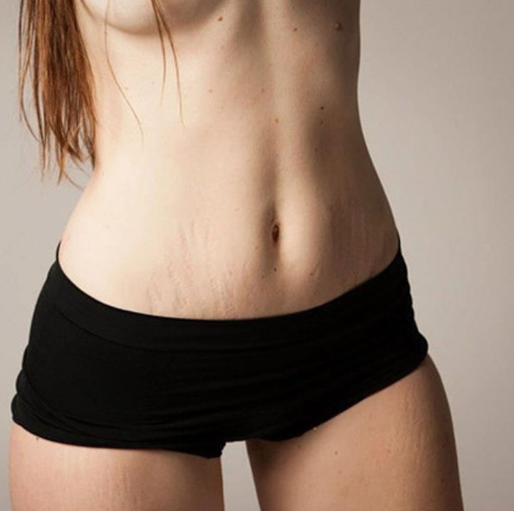 Το μεγαλείο της μητρότητας μέσα από φωτογραφίες που δείχνουν γυναικείο σώμα μετά τον τοκετό (pics)