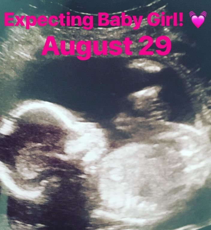 Οι 20 καλύτερες ανακοινώσεις εγκυμοσύνης, που ανακαλύψαμε στο Instagram (pics)