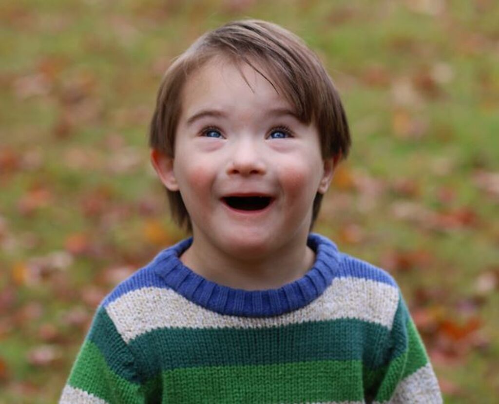 Απίθανες φωτογραφίες παιδιών με Σύνδρομο Down αποδεικνύουν πόσο υπέροχα είναι (pics)