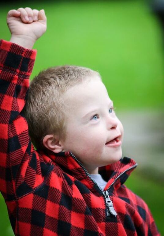 Απίθανες φωτογραφίες παιδιών με Σύνδρομο Down αποδεικνύουν πόσο υπέροχα είναι (pics)