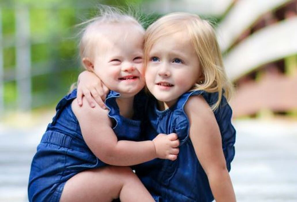 Απίθανες φωτογραφίες παιδιών με Σύνδρομο Down αποδεικνύουν πόσο υπέροχα είναι (pics)