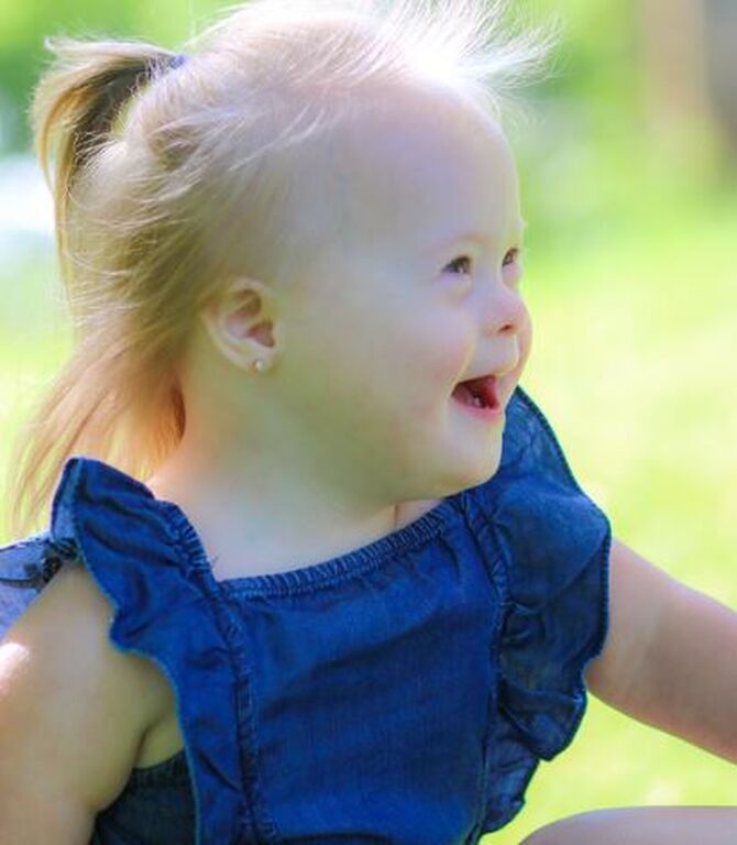 Απίθανες φωτογραφίες παιδιών με Σύνδρομο Down αποδεικνύουν πόσο υπέροχα είναι (pics)