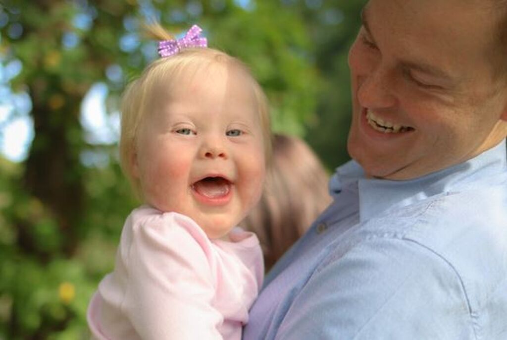 Απίθανες φωτογραφίες παιδιών με Σύνδρομο Down αποδεικνύουν πόσο υπέροχα είναι (pics)