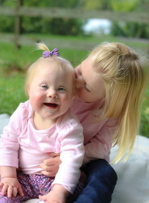 Απίθανες φωτογραφίες παιδιών με Σύνδρομο Down αποδεικνύουν πόσο υπέροχα είναι (pics)