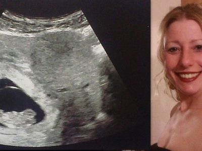 Μέλλουσα μαμά υποστηρίζει πως στο υπερηχογράφημα είδε δίπλα στο παιδί της τον φύλακα άγγελό του!