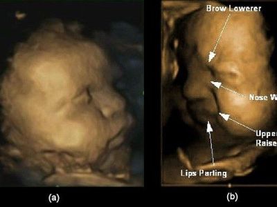 Tα αγέννητα μωρά εξασκούν τις εκφράσεις τους για τον τρόπο που θα αντιδρούν στον πραγματικό κόσμο! (φωτό)
