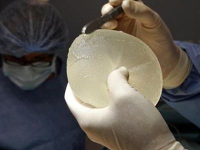 Ερευνα: Τα εμφυτεύματα στήθους μπορούν να προκαλέσουν προβλήματα στο έμβρυο