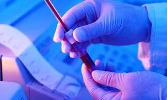 Διάγνωση συνδρόμου Down με μία απλή εξέταση αίματος