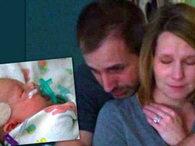 Γιατρός έσωσε ετοιμοθάνατο νεογέννητο χρησιμοποιώντας χειρουργική κόλλα στον εγκέφαλο για να κλείσει το ανεύρυσμα!