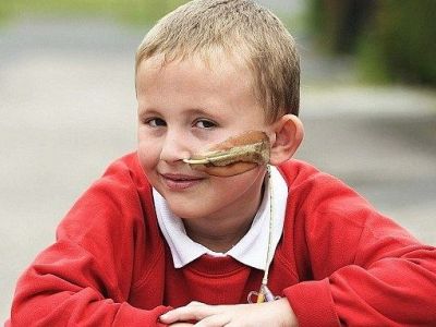 Το 6χρονο αγοράκι που είναι αλλεργικό σε όλες τις τροφές!