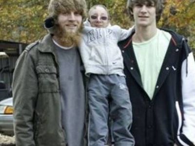 Αν και είναι 21 ετών έχει το σώμα ενός 2χρονου παιδιού (pics)