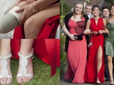 Tης έφτιαξαν πρόσθετο μέλος για να χορέψει στον χορό των αποφοίτων