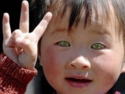 Το αγόρι που έχει τρελάνει την επιστημονική κοινότητα με τα μάτια του!