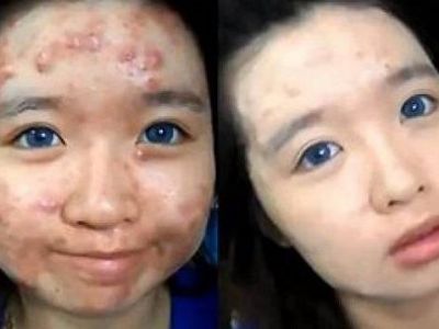 Βίντεο: Δεν θα πιστεύετε τη μεταμόρφωση αυτής της κοπέλας