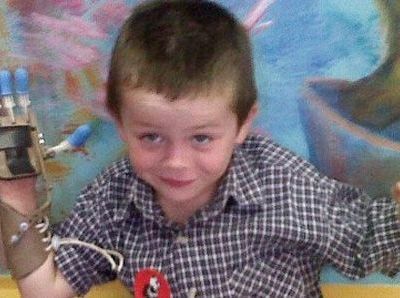 Δύο άγνωστοι δώρισαν σε 5χρονο αγοράκι το προσθετικό μέλος που χρειαζόταν! (εικόνες)