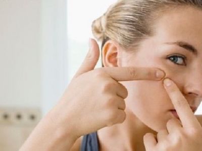 «Το παιδί μου έχει ακμή»-Τι πρέπει να κάνω