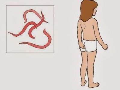 Το παιδί μου έβγαλε οξύουρους - Πώς τους αντιμετωπίζω;