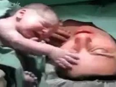 Το θαύμα της ζωής! Νεογέννητο δε θέλει να αποχωριστεί τη μαμά του! Δείτε το υπέροχο βίντεο