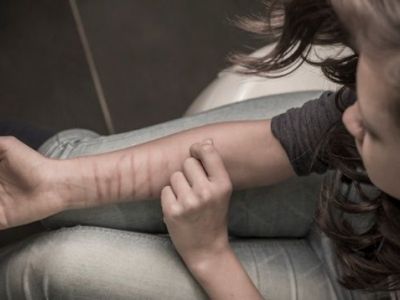 Διαστάσεις επιδημίας παίρνει ο αυτοτραυματισμός των εφήβων. Ολα όσα πρέπει να γνωρίζουμε