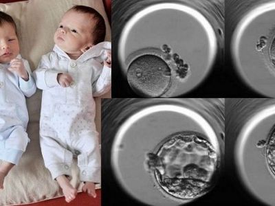 Το θαύμα της ζωής! Από την στιγμή της γονιμοποίησης μέχρι και την εξέλιξη του εμβρύου! (εικόνες)