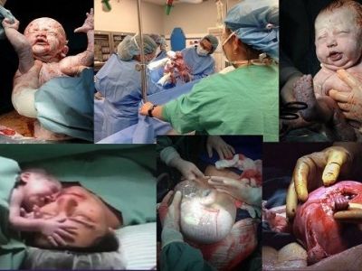H γέννηση! Οταν το θαύμα της ζωής μας αφήνει άφωνους. Δείτε τις συγκλονιστικές φωτογραφίες!