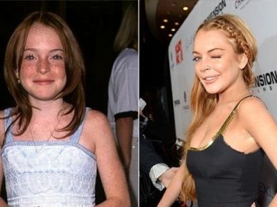 Απίστευτες φωτογραφίες διασημοτήτων του Χόλιγουντ πριν και μετά την εφηβεία τους!