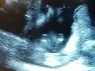 Εκπληκτικό:Η μαμά τραγουδά και το μωρό χτυπά παλαμάκια στην κοιλιά της!(βίντεο)