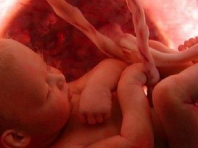 «Μου έσπασαν τα νερά για να δουν αν το παιδί μου είναι εγκεφαλικά νεκρό»