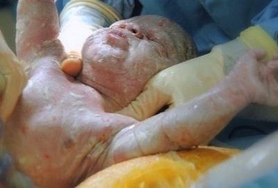 «Όσες ακούω που θέλουν καισαρική από μόνες τους, τις προτρέπω να αλλάξουν γνώμη»