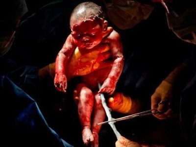 Μοναδικές φωτογραφίες μωρών, δευτερόλεπτα μετά τη γέννησή τους!(εικόνες)