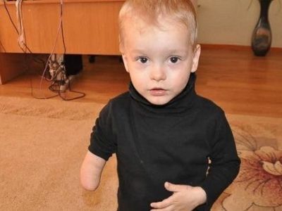 Συγκινητικό:Το υιοθετημένο αγόρι που γεννήθηκε με ένα χέρι, διαπιστώνει ότι δεν είναι μόνος του (φωτό)