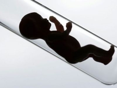 Εξωσωματική γονιμοποίηση: Όλα όσα πρέπει να γνωρίζετε από τον γυναικολόγο του Mothersblog