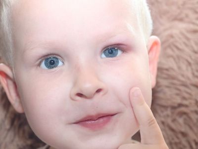 Τι είναι ο χρυσίζων σταφυλόκοκκος και πώς μεταδίδεται στα βρέφη