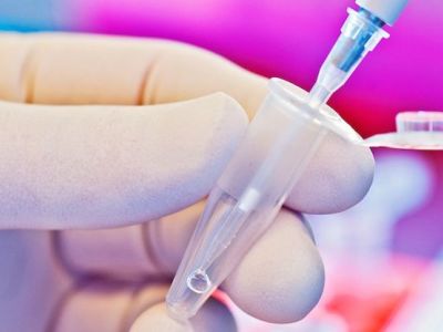 Μάθετε τα πάντα για τον προεμφυτευτικό γενετικό έλεγχο, από τον γυναικολόγο του Mothersblog!