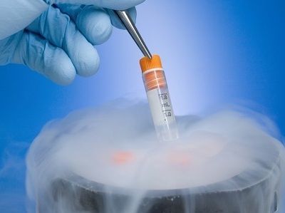 Κατάψυξη ωαρίων- Όλα όσα πρέπει να γνωρίζετε