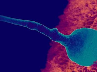 Η καθημερινές συνήθειες επηρεάζουν την ποιότητα του σπέρματος