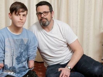 Έφηβος με ακρωτηριασμένα άκρα κλήθηκε να αποδείξει την αναπηρία του! (φωτό)