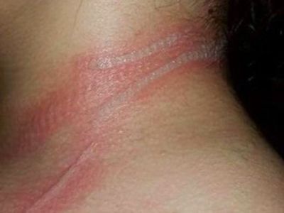 Η κόρη της ούρλιαζε από πόνο και εκείνη δεν ήξερε γιατί. Τώρα προειδοποιεί και τους άλλους γονείς!