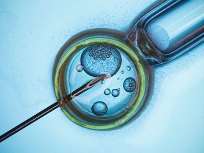 Τεχνητή γονιμοποίηση: Τι προβλέπει ο νόμος