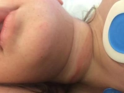 «Η κόρη μου παραλίγο να πνιγεί στον παιδικό σταθμό» - Η εξομολόγηση μιας μαμάς που σοκάρει