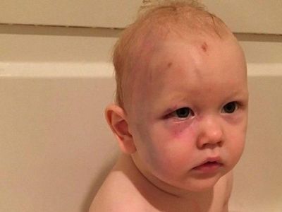 Επέστρεψαν στο σπίτι και βρήκαν το γιο τους γεμάτο μώλωπες