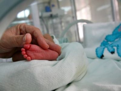 Βρέφος γεννήθηκε με σπάνια ασθένεια και όψη 80χρονου