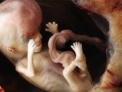 Καρέ - καρέ η ανάπτυξη του εμβρύου μέσα στη μήτρα:  Ρεαλιστικές φώτο που κόβουν την ανάσα