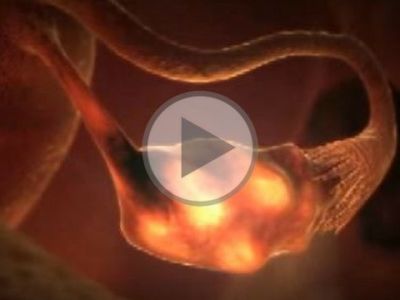 Πώς γίνεται η εξωσωματική γονιμοποίηση βήμα-βήμα (βίντεο)