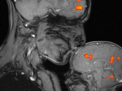 Πώς η πατρότητα επηρεάζει τον εγκέφαλο του άνδρα;