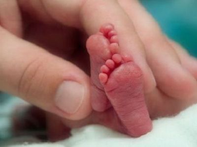 Eξωτερική τεχνητή μήτρα υποστηρίζει υπερβολικά πρόωρα μωρά